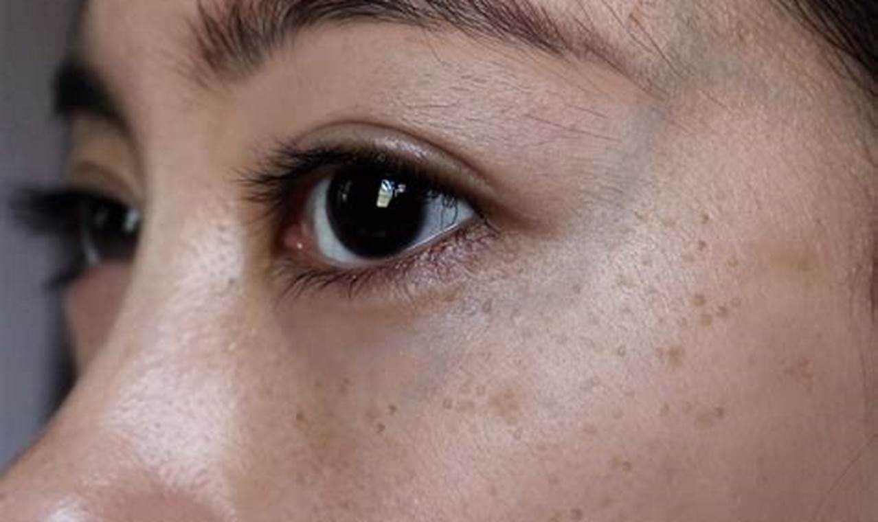 Cara Mengatasi Flek Hitam Di Wajah